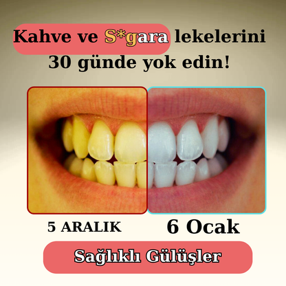 Klynax Pratik Diş Fırçası: 30 Günde Daha Beyaz Dişler