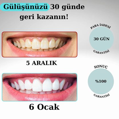 Klynax Pratik Diş Fırçası: 30 Günde Daha Beyaz Dişler
