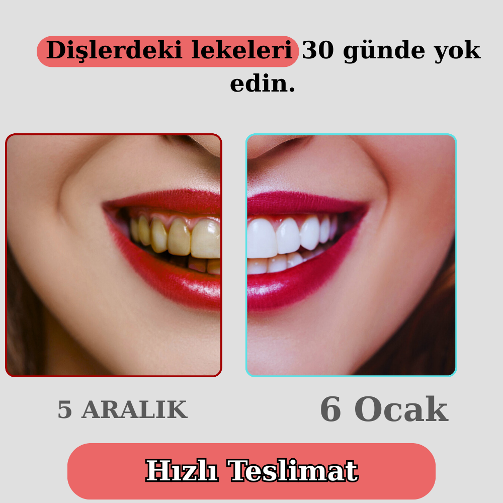 Klynax Pratik Diş Fırçası: 30 Günde Daha Beyaz Dişler