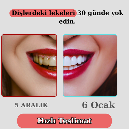 Klynax Pratik Diş Fırçası: 30 Günde Daha Beyaz Dişler